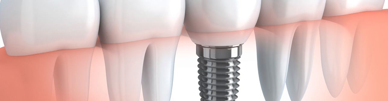 Homepage Fa. Zahnarztpraxis Kristin Beier: Startbild